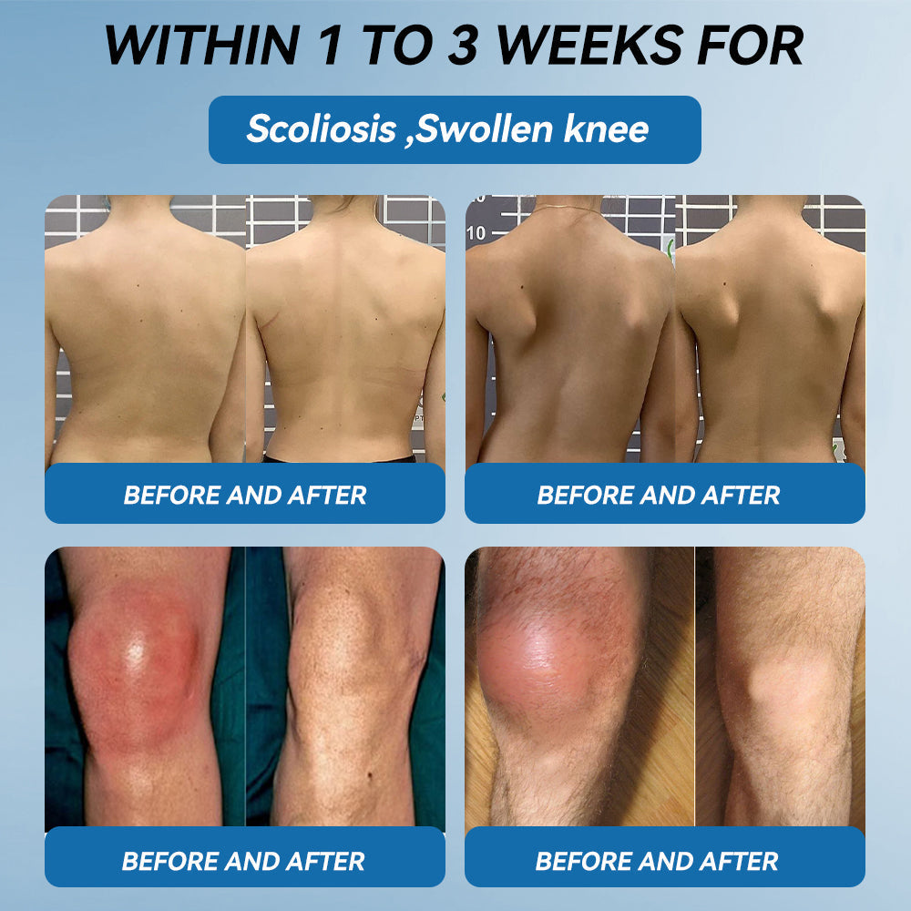 𝖯𝗂𝖼𝗱𝗼® BPC-157 Joint Healing Cream$$Treats Arthritis, Neuropathy, Rheumatism, Sports Injuries & More👍