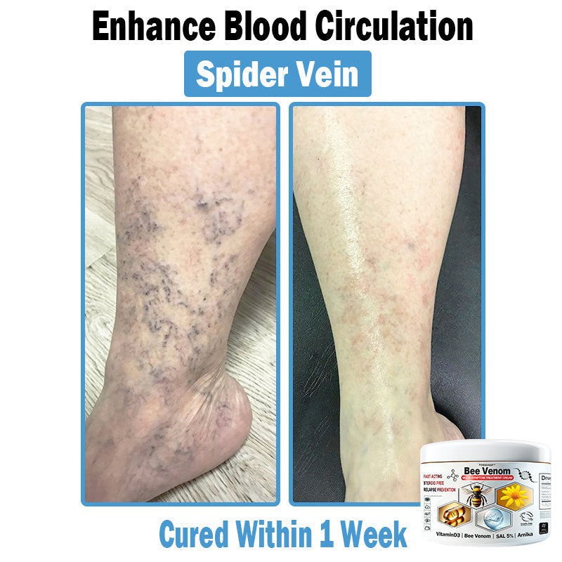 【⏰Promotion in the last 30 minutes!⏰】