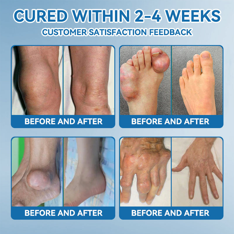 𝖯𝗂𝖼𝗱𝗼® BPC-157 Joint Healing Cream🦴Treats Arthritis, Neuropathy, Rheumatism, Sports Injuries & More🦿🦿🦿）