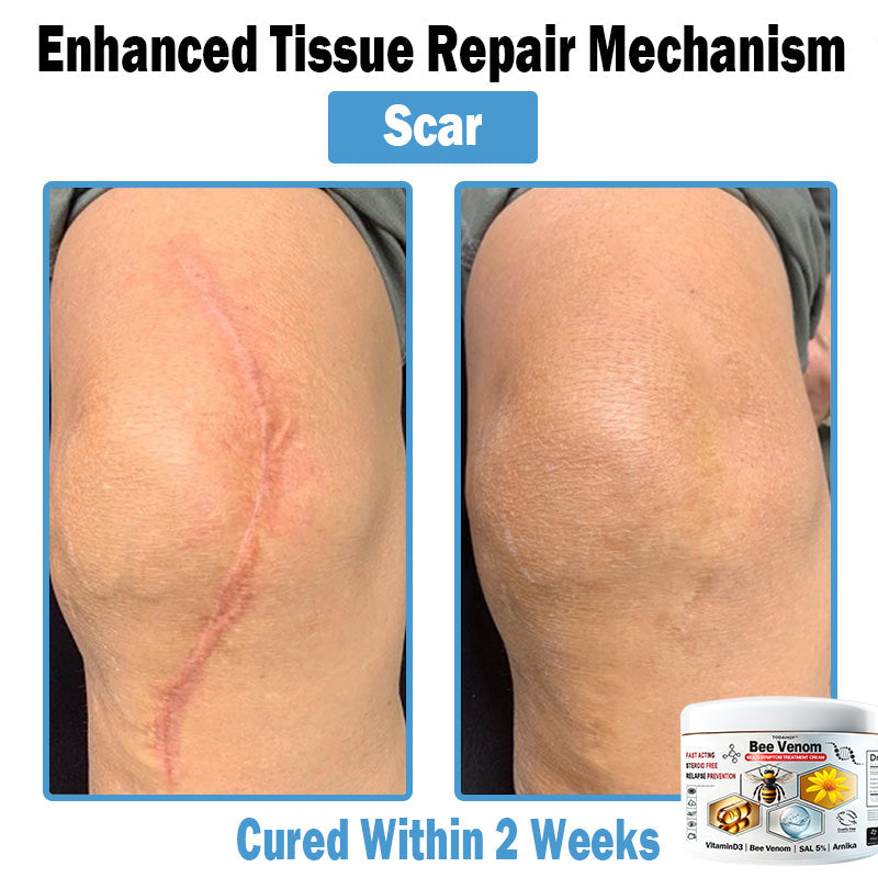 【⏰Promotion in the last 30 minutes!⏰】