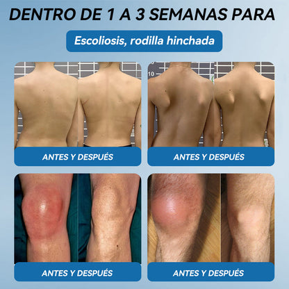 𝐓𝐢𝐞𝐧𝐝𝐚 𝐎𝐟𝐢𝐜𝐢𝐚𝐥 | 💧𝑷𝐢𝐜𝐝o® 𝐵𝖯C-1𝟧𝟩 𝐶𝑟𝑒𝑚𝑎 𝒅𝒆 𝑹𝒆𝒄𝒖𝒑𝒆𝒓𝒂𝒄𝒊ó𝒏 𝖠𝗋𝗍𝗂𝖼𝗎𝗅𝖺𝗋𝑇𝑟𝑎𝑡𝑎 𝑙𝑎 𝑎𝑟𝑡𝑟𝑖𝑡𝑖𝑠, 𝑙𝑎 𝑛𝑒𝑢𝑟𝑜𝑝𝑎𝑡í𝑎, 𝑒𝑙 𝑟𝑒𝑢𝑚𝑎𝑡𝑖𝑠𝑚𝑜, 𝑙𝑎𝑠 𝑙𝑒𝑠𝑖𝑜𝑛𝑒𝑠 𝑑𝑒𝑝𝑜𝑟𝑡𝑖𝑣𝑎𝑠 𝑦 𝑚á𝑠.