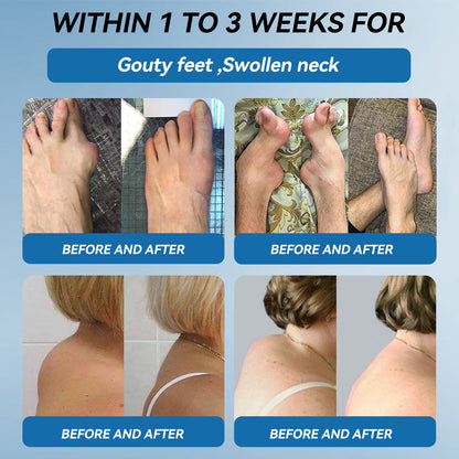 𝖯𝗂𝖼𝗱𝗼® BPC-157 Joint Healing Cream🦴Treats Arthritis, Neuropathy, Rheumatism, Sports Injuries & More🦿🦿🦿）